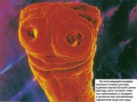 На микрофотографии показана головка цестода, в данном случае бычьего цепня