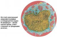 На микрофотографии в псевдоцветах виден В-лимфоцит - белая клетка крови