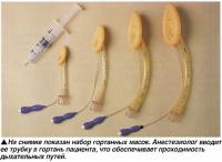 На снимке показан набор гортанных масок