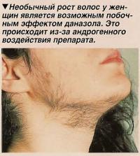 Необычный рост волос у женщин является возможным побочным эффектом даназола