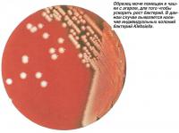 Образец мочи помещен в чашки с агаром, для того чтобы ускорить рост бактерий
