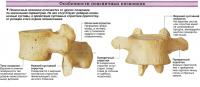 Особенности поясничных позвонков
