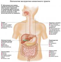 Патология желудочно-кишечного тракта