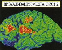 ПЭТ помогает изучать функции мозга и кровоток, выявляя зоны, отвечающие за речь и память