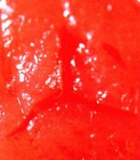 Пиявка оставляет на коже Y-образный след. Три челюсти расходятся, вызывая кровотечение
