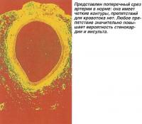 Поперечный срез артерии в норме