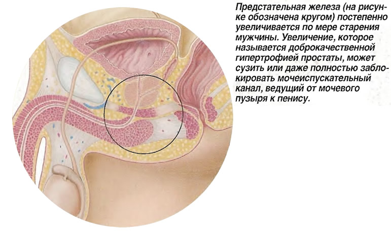 Предстательная железа (на рисунке обозначена кругом)