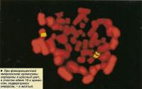 При флюоресцентной микроскопии хромосомы окрашены в красный цвет