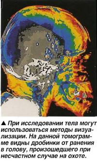 При исследовании тела могут использоваться методы визуализации