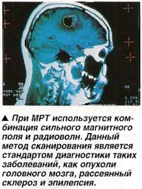 При МРТ используется комбинация сильного магнитного поля и радиоволн.