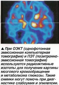 При ОЭКТ и ПЭТ используются радиоактивные изотопы