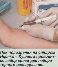При подозрении на синдром Иценко-Кушинга проводится забор крови для исследования