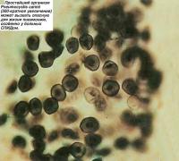 Простейший организм Pneumocystis carinii