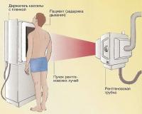 Проведение ренгенографии грудной клетки