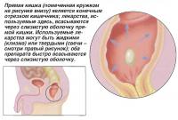 Прямая кишка является конечным отрезком кишечника