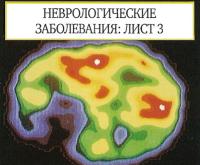Радиоактивные трассеры в ПЭТ изучают кровоток, состояние мышцы и метаболизм сердца