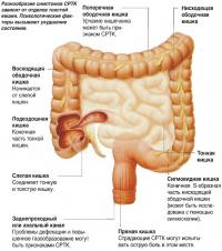 Разнообразие симптомов СРТК зависит от отделов толстой кишки