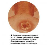 Рецидивирующие карбункулы могут означать наличие источника инфекции