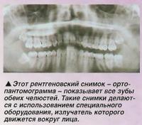 Рентгеновский снимок показывает все зубы обеих челюстей