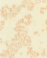 Salmonella paratyphi - причина паратифозной лихорадки
