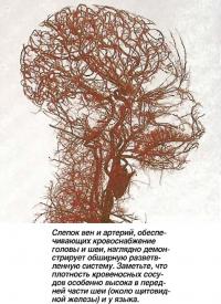 Слепок вен и артерий обеспечивающих кровоснабжение головы и шеи