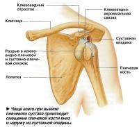 Смещение плечевой кости вниз и наружу из суставной впадины