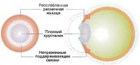 Смотрим на отдаленный объект