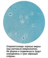 Сперматозоиды хорошо видны под световым микроскопом