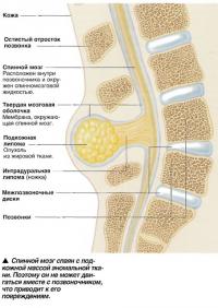 Спинной мозг спаян с подкожной массой аномальной ткани