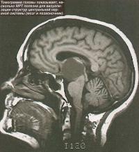 Структура головы, полученная с помощью МРТ