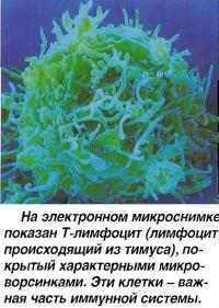 Т-лимфоцит (лимфоцит, происходящий из тимуса), покрытый характерными микроворсинками