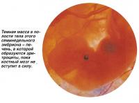 Темная масса в полости тела семинедельного эмбриона - печень