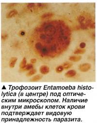 Трофозоит Entamoeba histolytica (в центре) под оптическим микроскопом