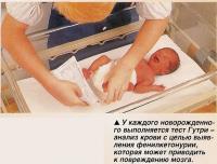 У каждого новорожденного выполняется тест Гутри -анализ крови с целью выявления фенилкетонурии