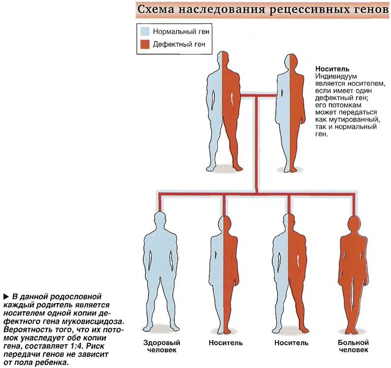 Дефектный ген что это такое. Муковисцидоз Тип наследования. Муковисцидоз схема наследования. Муковисцидоз носитель. Муковисцидоз аутосомно-рецессивное заболевание.