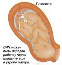 ВИЧ может быть передан ребенку через плаценту еще в утробе матери