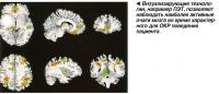 Визуализирующие технологии, например ПЭТ, позволяют наблюдать наиболее активные очаги мозга