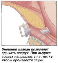 Внешний клапан позволяет вдыхать воздух