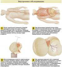 Внутреннее обследование