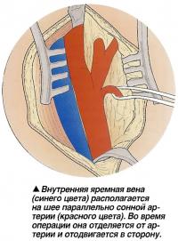 Внутренняя яремная вена располагается на шее параллельно сонной артерии