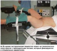 Во время гистероскопии пациентка лежит на гинекологическом кресле с приподнятыми ногами