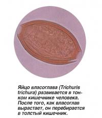 Яйцо власоглава развивается в тонком кишечнике человека