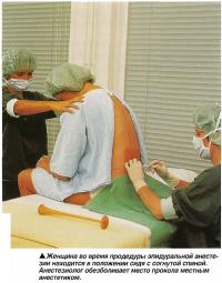 Женщина во время продедуры эпидуральной анестезии находится в положении сидя с согнутой спиной